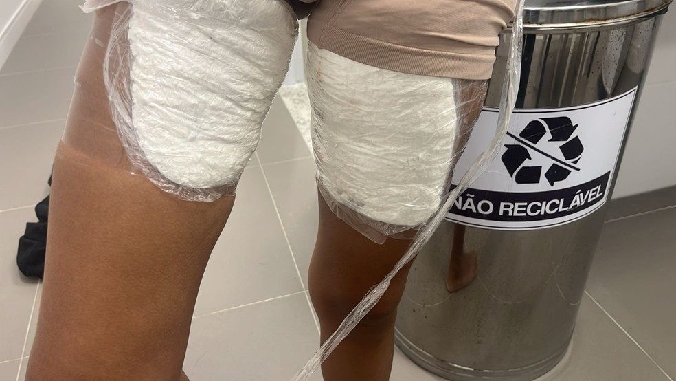 Mulher é presa no Aeroporto de João Pessoa com drogas coladas ao corpo 2 drogas mulher aeroporto