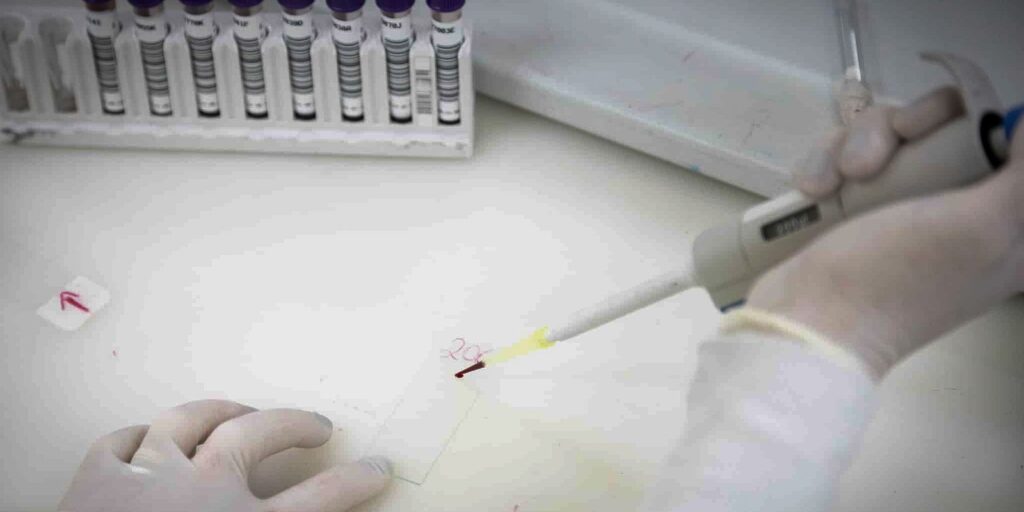 Exames descartam ebola em imigrante da República Democrática do Congo 49 instituto-de-infectologia-emilio-ribas.jpg